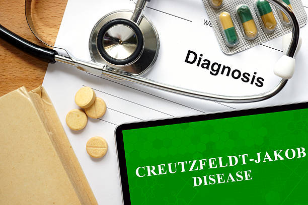 Creutzfeldt-Jakob disease (CJD)